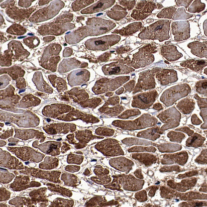 Cardiac Troponin I Recombinant Rabbit mAb (S-1352-15)