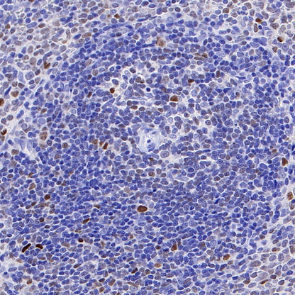 c-Myc Recombinant Rabbit mAb (S-519-54)