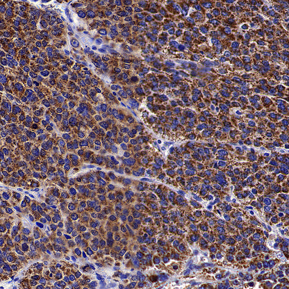 Aldh5a1 Recombinant Rabbit mAb (S-4135-76)