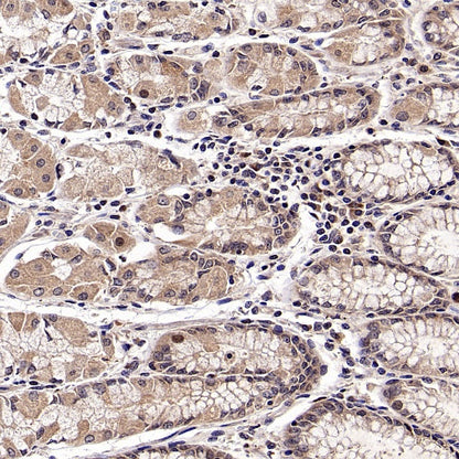 SCAMP1 Rabbit Polyclonal Antibody