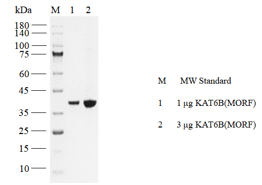 KAT6B Protein, Human
