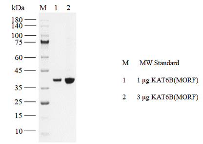KAT6B Protein, Human