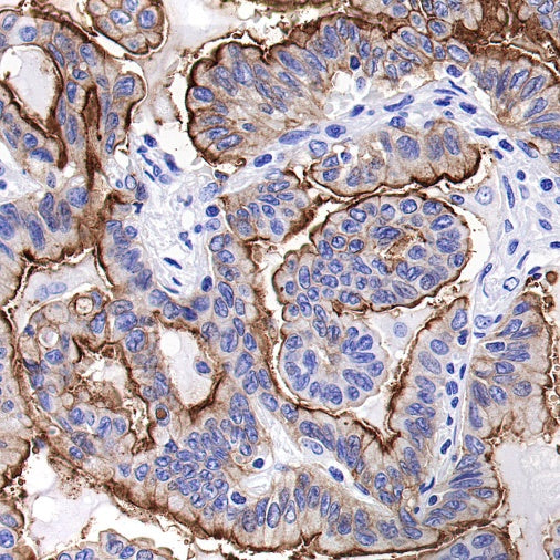 Aquaporin 5/AQP5 Recombinant Rabbit mAb (S-1622-5)