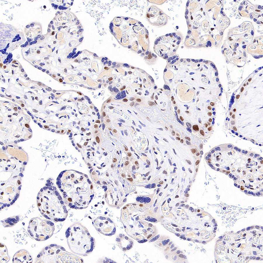 Chk2 Recombinant Rabbit mAb