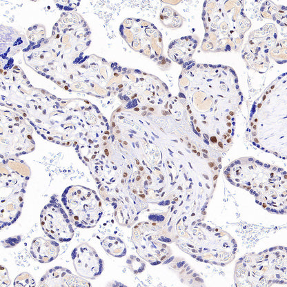 Chk2 Recombinant Rabbit mAb