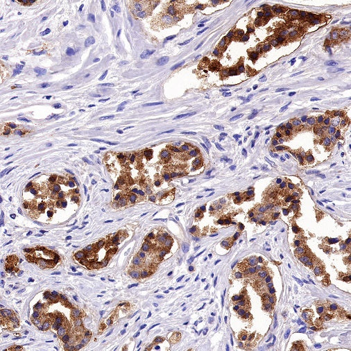 GDF-15 Recombinant Rabbit mAb (S-1012-42)
