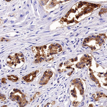 GDF-15 Recombinant Rabbit mAb (S-1012-42)
