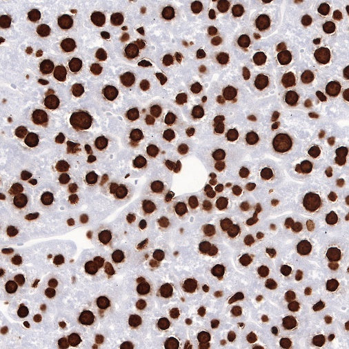 Histone H3 (tri methyl K27) Recombinant Rabbit mAb (SDT-431-118)