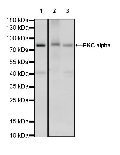 PKC alpha Recombinant Rabbit mAb (S-624-36)