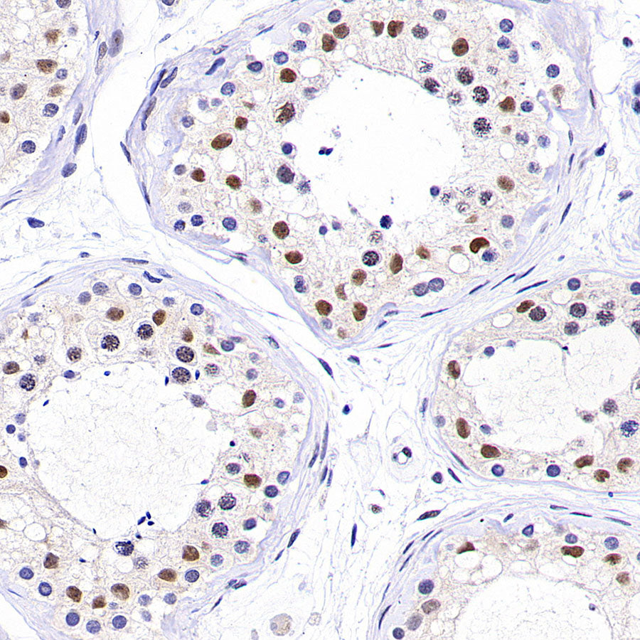 PAPSS1 Recombinant Rabbit mAb (S-3516-23)