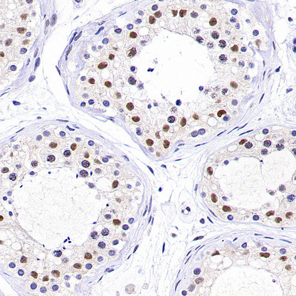 PAPSS1 Recombinant Rabbit mAb (S-3516-23)