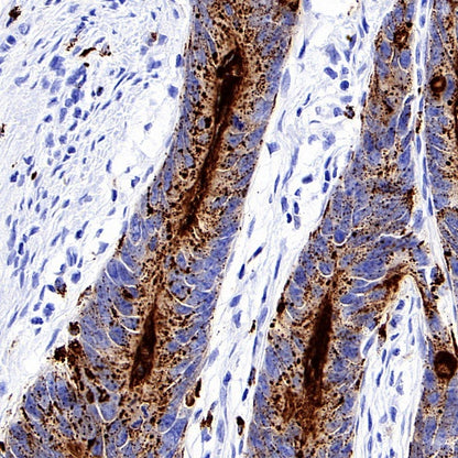 CEACAM6 Recombinant Rabbit mAb (S-720-54)
