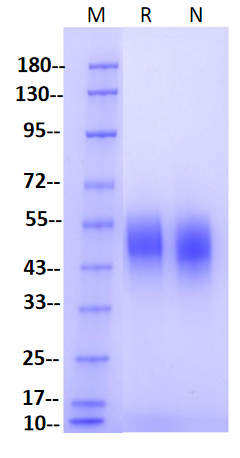 Fc γ RI/CD64 His Tag Protein, Mouse