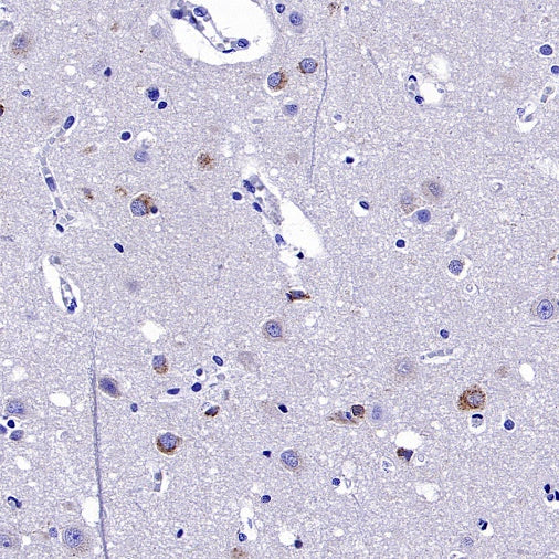 SEZ6 Recombinant Rabbit mAb (SDT-2097-737)