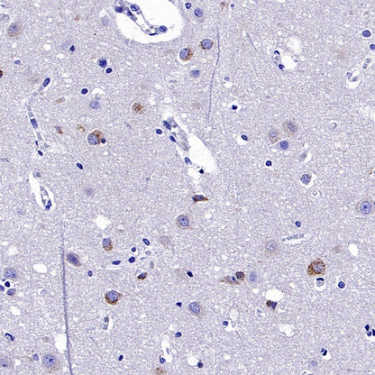 SEZ6 Recombinant Rabbit mAb (SDT-2097-737)