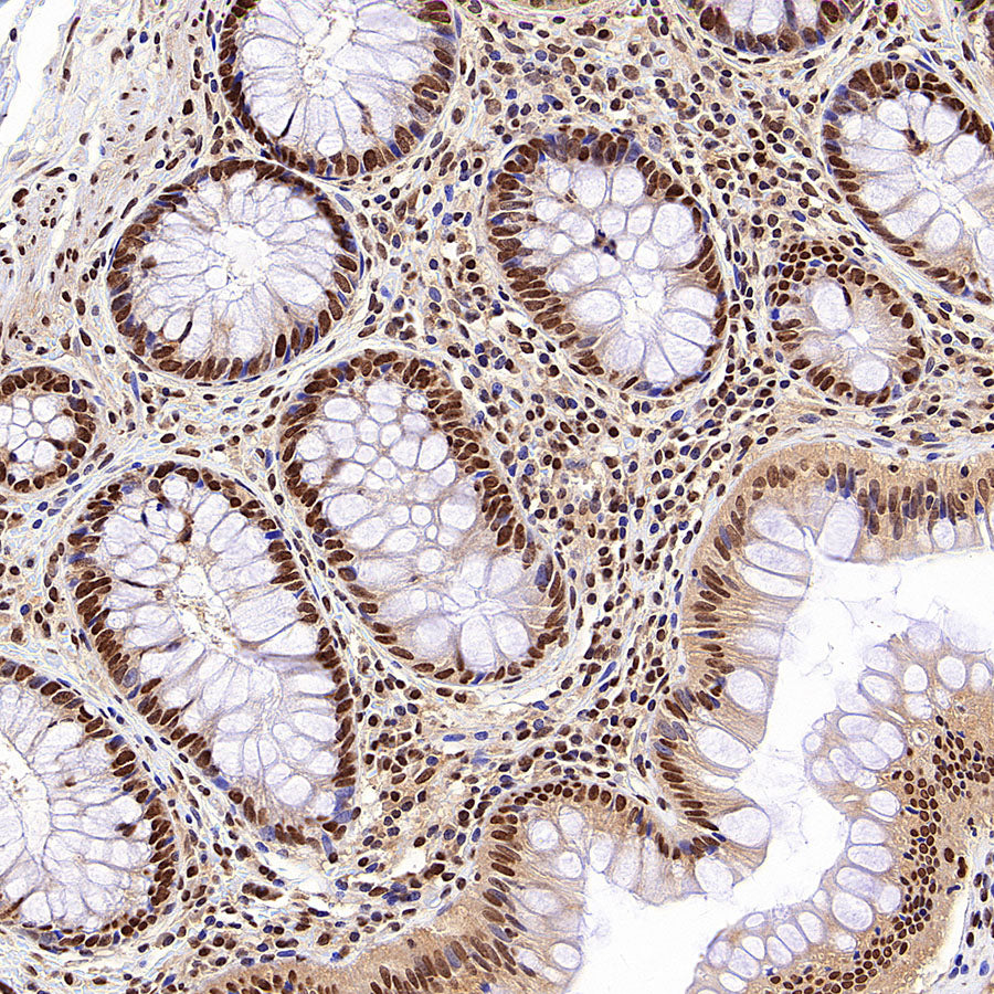 hnRNP A1 Recombinant Rabbit mAb