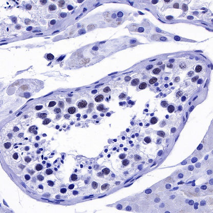 RNA polymerase II CTD repeat YSPTSPS (phosphor S2) Recombinant Rat mAb (S-R199)