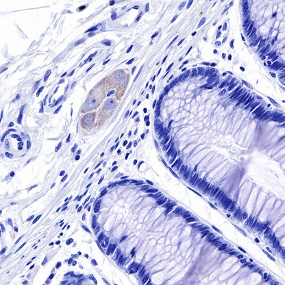Tau Recombinant Rabbit mAb (SDT-171-67)