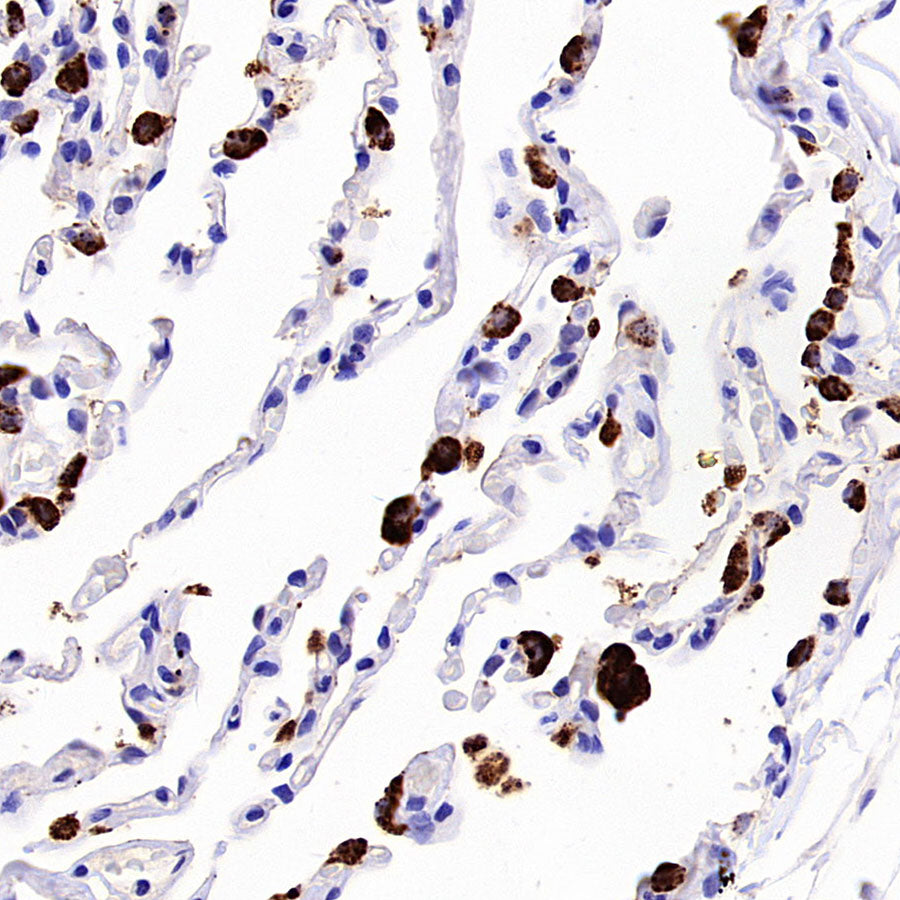 Napsin A Recombinant Mouse mAb,PBS Only (SDT-4204)