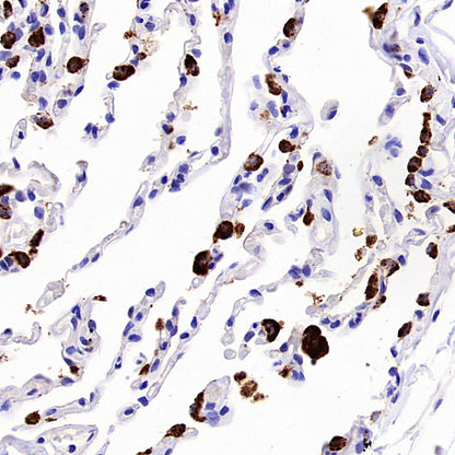 Napsin A Recombinant Mouse mAb,PBS Only (SDT-4204)