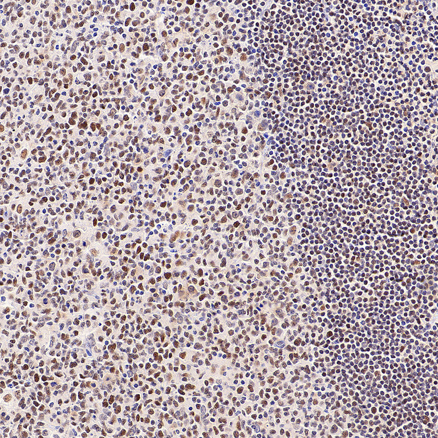 Chk2 Recombinant Rabbit mAb