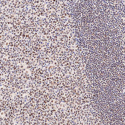 Chk2 Recombinant Rabbit mAb