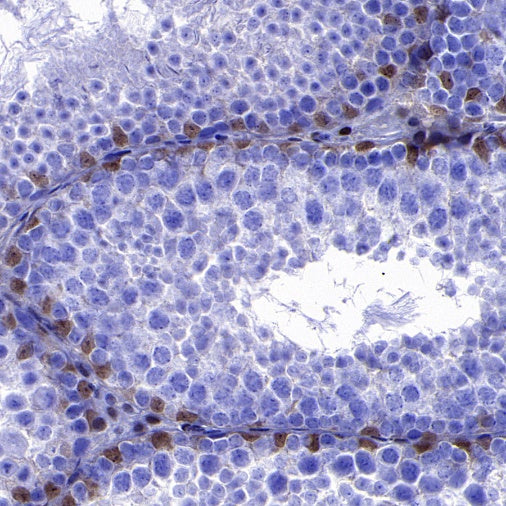 p27 Recombinant Rabbit mAb (S-141-135)