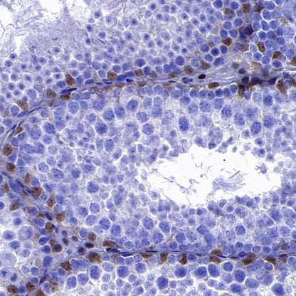 p27 Recombinant Rabbit mAb (S-141-135)