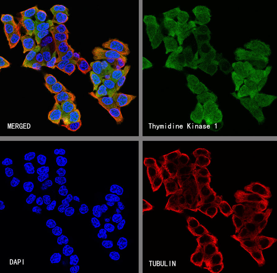 Thymidine Kinase 1 Recombinant Rabbit mAb (S-4127-43)