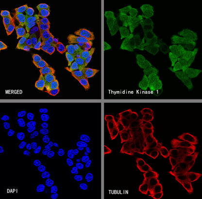 Thymidine Kinase 1 Recombinant Rabbit mAb (S-4127-43)