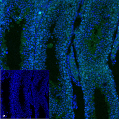Ki67 Recombinant Rabbit mAb (Alexa Fluor® 488 Conjugate) (SDT-R459)