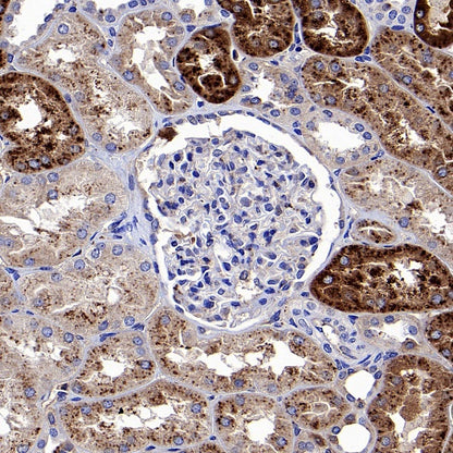 Apo-D Recombinant Rabbit mAb (S-1869-50)
