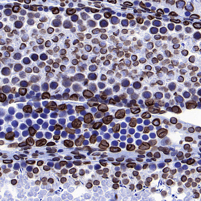 Lamin B1 Recombinant Mouse mAb (S-4865)