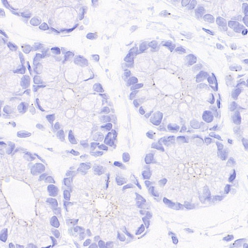 Pericentrin Recombinant Rabbit mAb (S-3493)