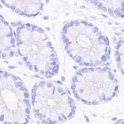 Pericentrin Recombinant Rabbit mAb (S-3493)