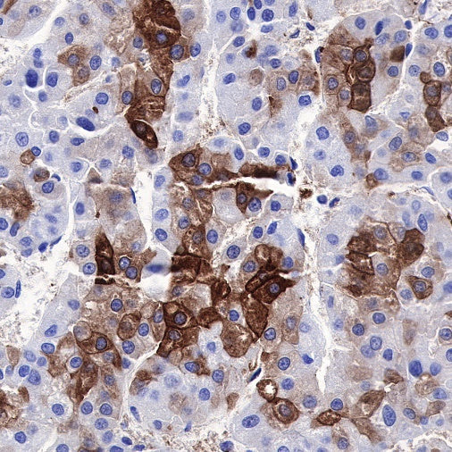 FASN Recombinant Rabbit mAb (S-682-32)