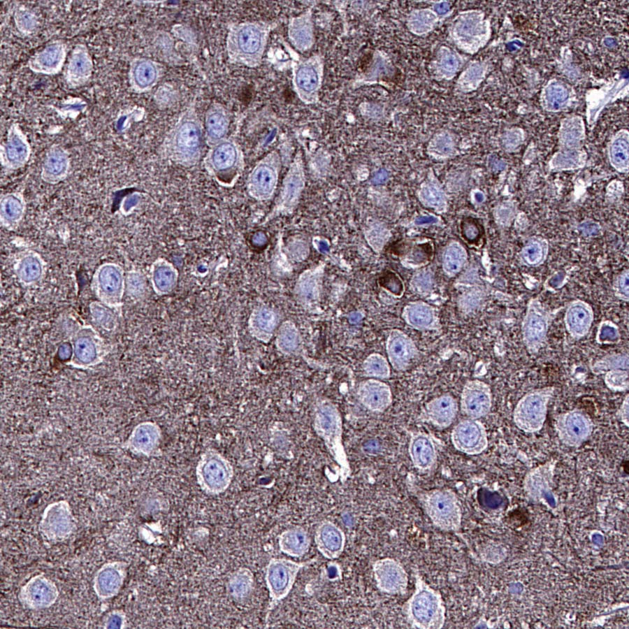 BIN1 Recombinant Rabbit mAb (S-4287-18)