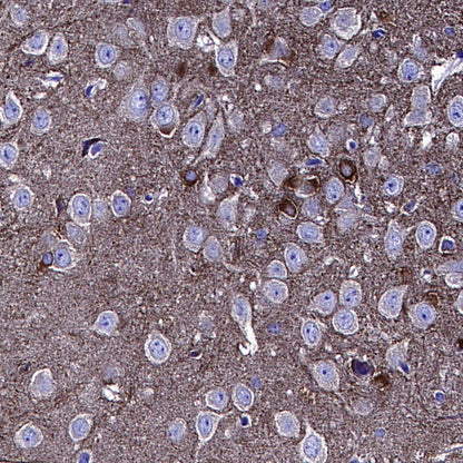 BIN1 Recombinant Rabbit mAb (S-4287-18)