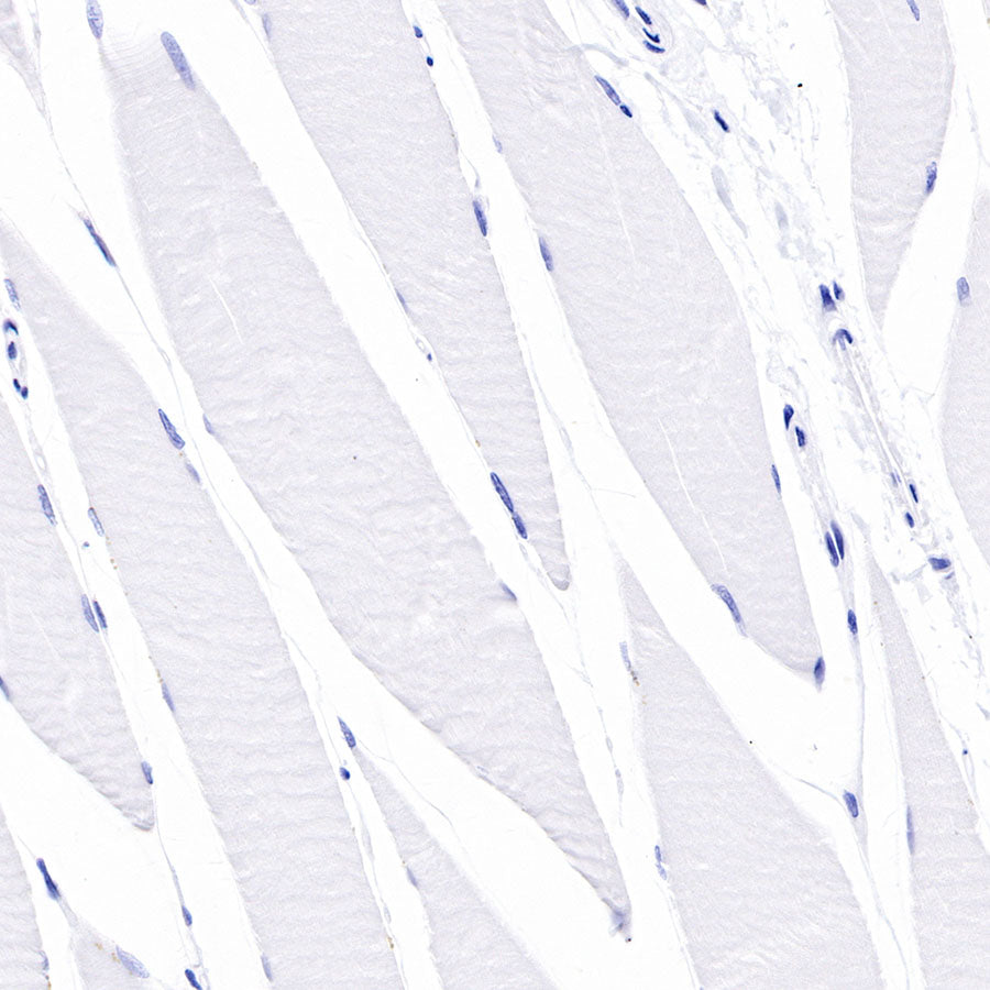 CD138 Recombinant Rabbit mAb,PBS Only (SDT-R120)