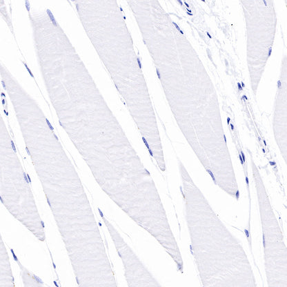 CD138 Recombinant Rabbit mAb,PBS Only (SDT-R120)