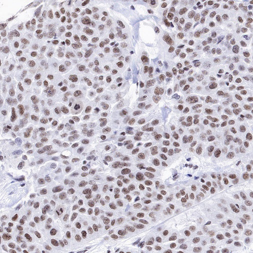 PIAS1 Recombinant Rabbit mAb (S-1430-7)
