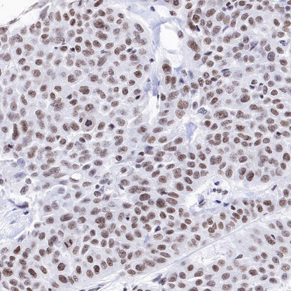 PIAS1 Recombinant Rabbit mAb (S-1430-7)