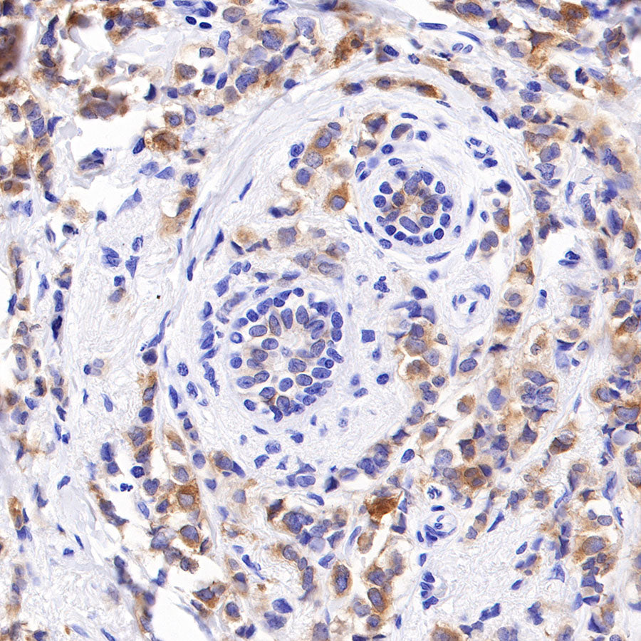 p120 Catenin Recombinant Rabbit mAb (SDT-350-75)