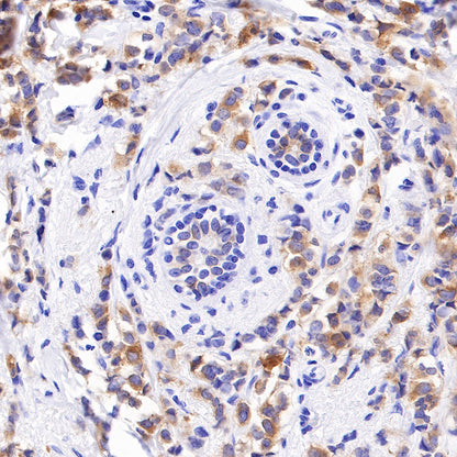 p120 Catenin Recombinant Rabbit mAb (SDT-350-75)
