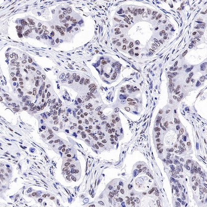 E2F4 Recombinant Rabbit mAb (S-586-214)
