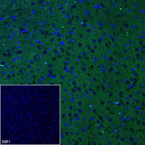 p35/25 Recombinant Rabbit mAb (S-2719-47)