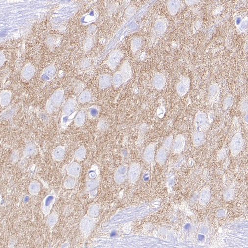 LOX Recombinant Rabbit mAb (S-1647-49)