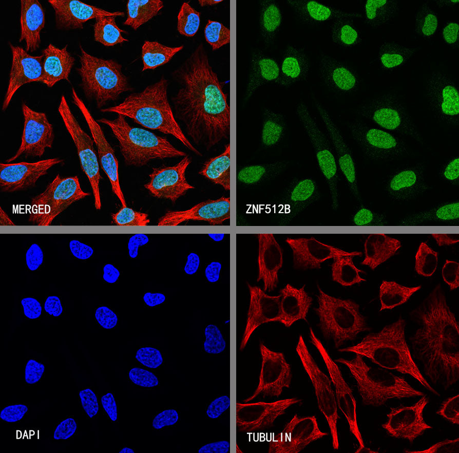 ZNF512B Recombinant Rabbit mAb (S-3432-59)