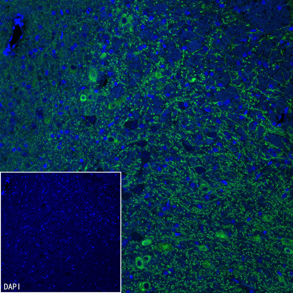 GABRA1 Recombinant Rabbit mAb (S-3254-10)