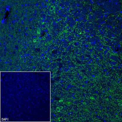 GABRA1 Recombinant Rabbit mAb (S-3254-10)